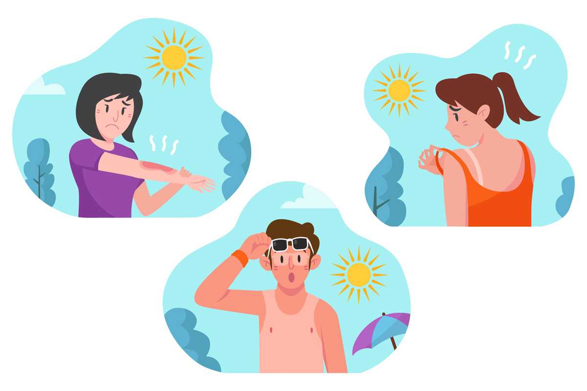 що таке сонячний дерматит